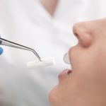 видалення зуба