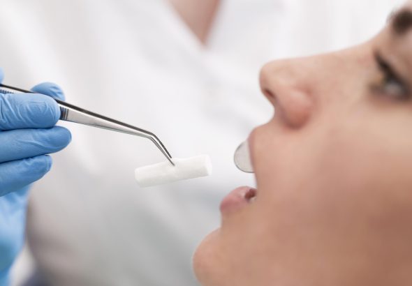 видалення зуба