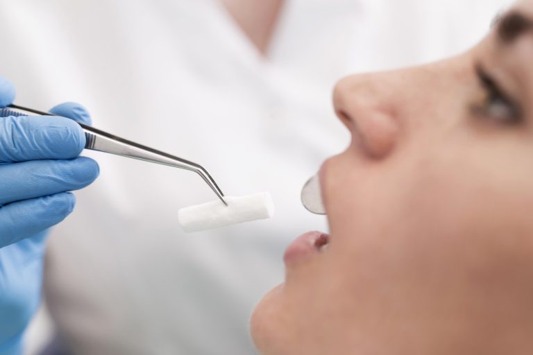 видалення зуба